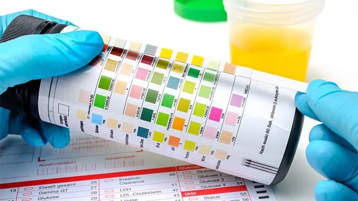 Urineanalysis test kit being held by gloved hands